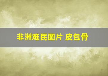 非洲难民图片 皮包骨